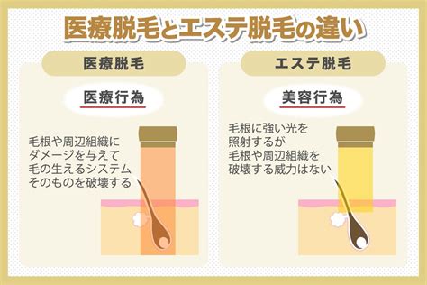 チンコ脱毛|男性器の医療脱毛とは？